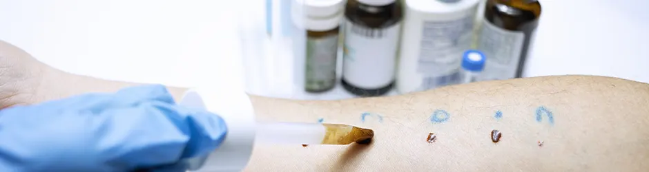 Stages of Allergy Treatment and Follow-Up